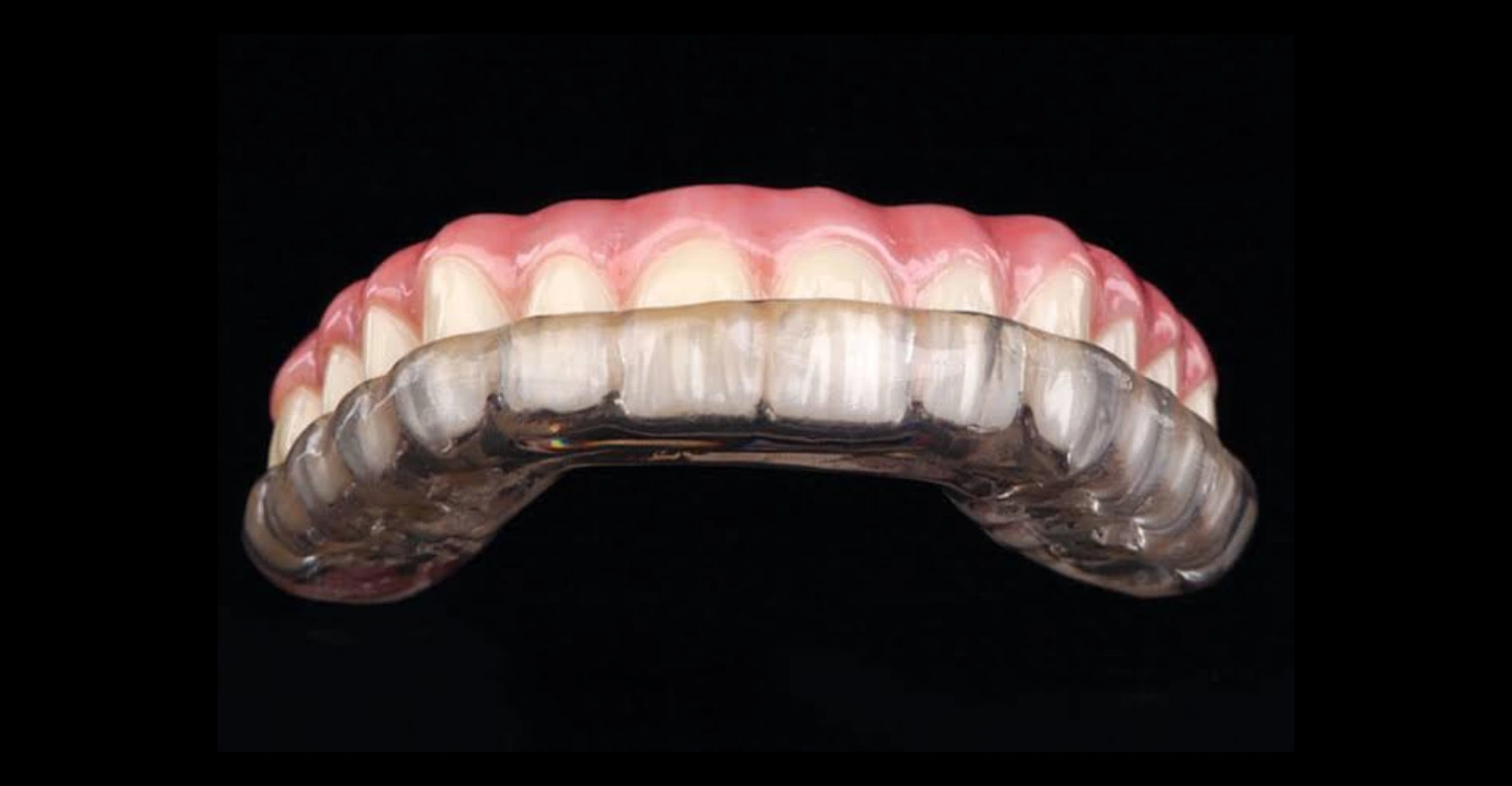 is a night guard considered orthodontic Inblog